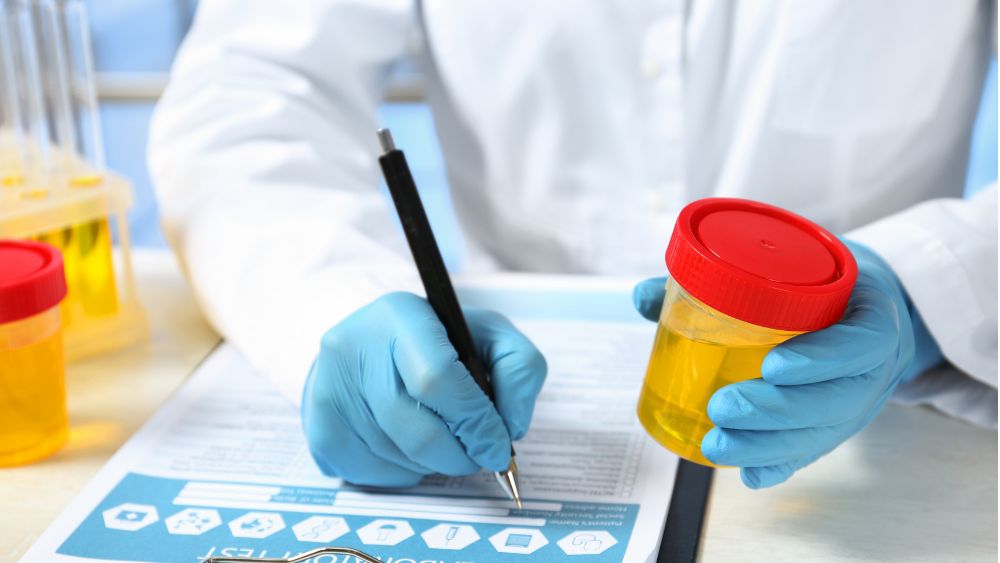 Doctor reviewing urine report or laboratory testing.